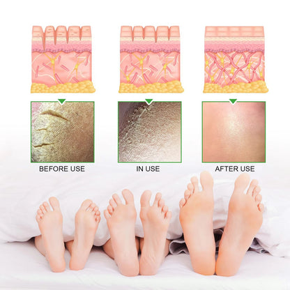 South Moon - 42% Urea Cream + 2% Salicylic Acid